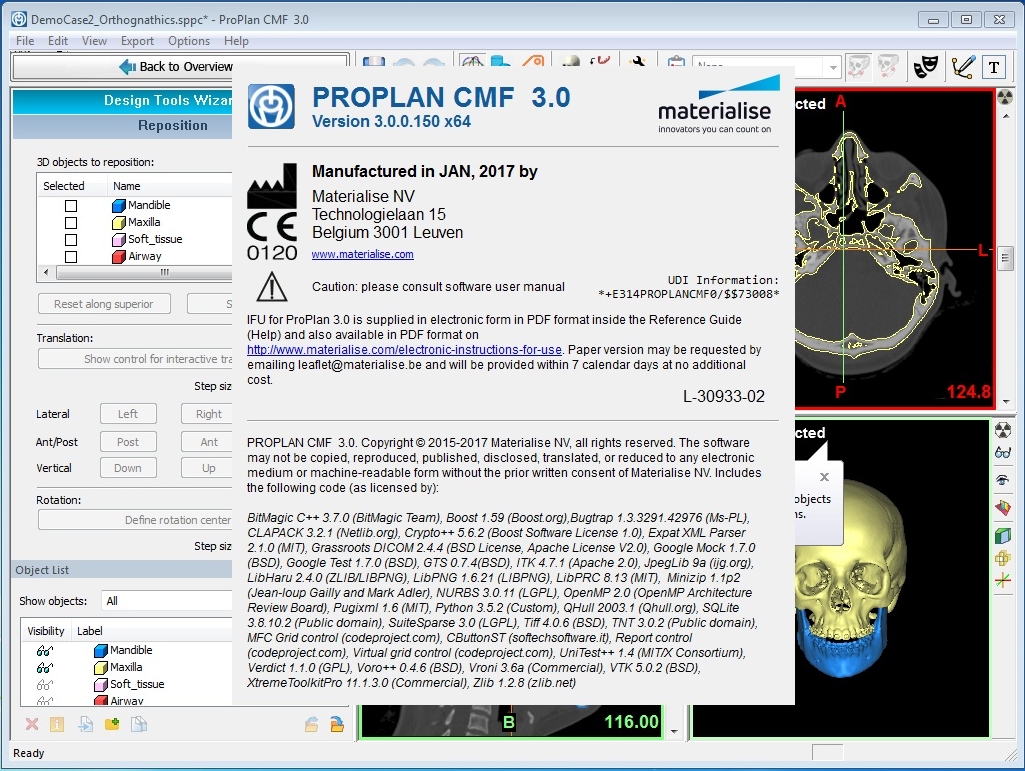 Materialise ProPlan CMF 3.0