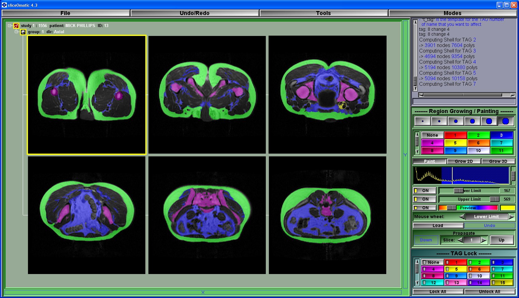 tomovision sliceOmatic 5.0 Rev-9 x64